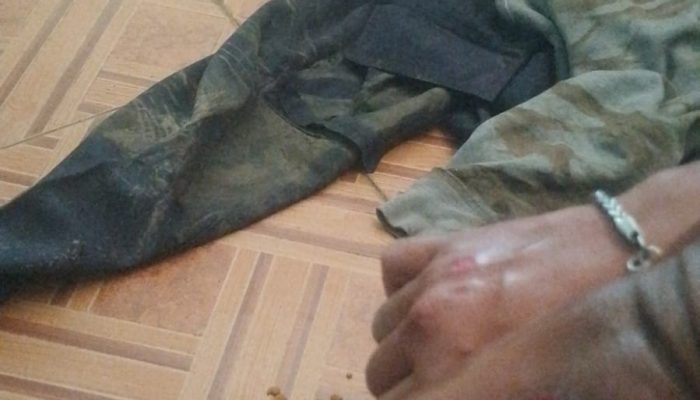 Seorang Pengendara Laka Lantas Diduga Akibat Dampak Proyek Tol Jakarta – Cikampek II