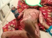 Miris!! Akibat Permainan Beleson Seorang Anak Harus Dilarikan Ke RSUD Karawang